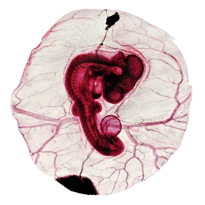 96 Hour Chick Embryo Serial Section